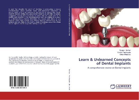 Learn & Unlearned Concepts of Dental Implants: A comprehensive review on Dental Implants