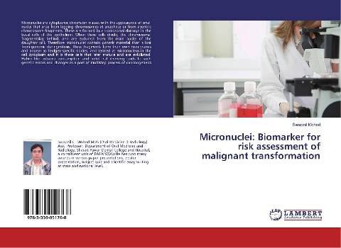 Micronuclei: Biomarker for risk assessment of malignant transformation
