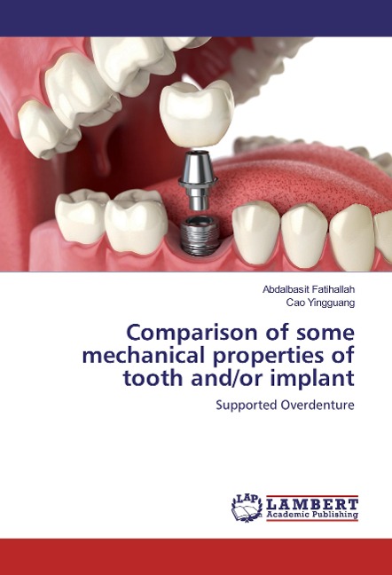 Comparison of some mechanical properties of tooth and/or implant: Supported Overdenture