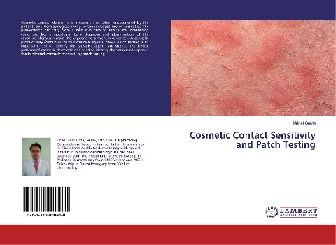 Cosmetic Contact Sensitivity and Patch Testing