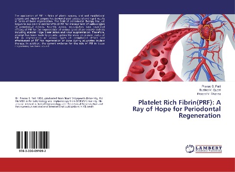 Platelet Rich Fibrin(PRF): A Ray of Hope for Periodontal Regeneration