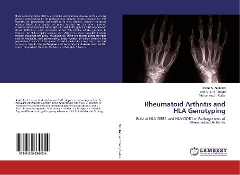 Rheumatoid Arthritis and HLA Genotyping: Role of HLA-DRB1 and HLA-DQB1 in Pathogenesis of Rheumatoid Arthritis