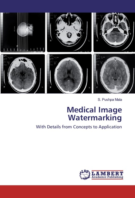 Medical Image Watermarking: With Details from Concepts to Application