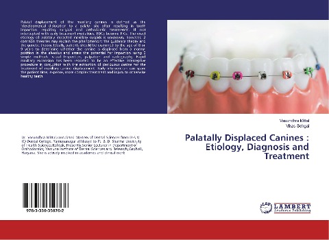Palatally Displaced Canines : Etiology, Diagnosis and Treatment