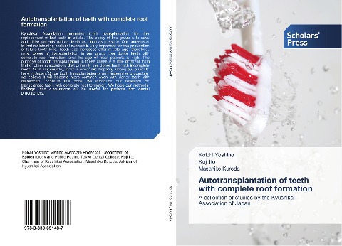 Autotransplantation of teeth with complete root formation: A collection of studies by the Kyushikai Association of Japan