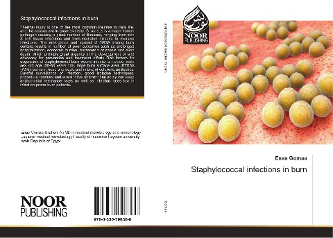 Staphylococcal infections in burn