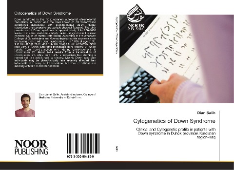 Cytogenetics of Down Syndrome: Clinical and Cytogenetic profile in patients with Down syndrome in Duhok province\ Kurdistan region-Iraq