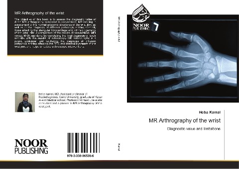 MR Arthrography of the wrist: Diagnostic value and limitations