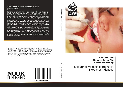 Self adhesive resin cements in fixed prosthdontics