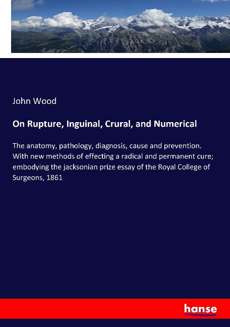 On Rupture, Inguinal, Crural, and Numerical: The anatomy, pathology, diagnosis, cause and prevention. With new methods of effecting a radical and permanent cure; embodying the jacksonian prize essay of the Royal College of Surgeons, 1861