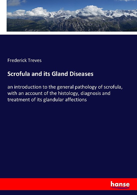 Scrofula and its Gland Diseases: an introduction to the general pathology of scrofula, with an account of the histology, diagnosis and treatment of its glandular affections