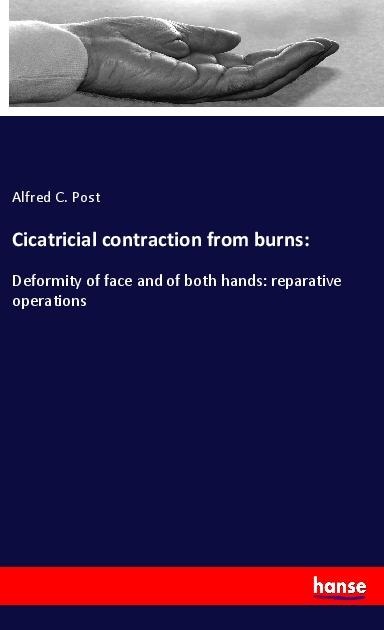 Cicatricial contraction from burns:: Deformity of face and of both hands: reparative operations