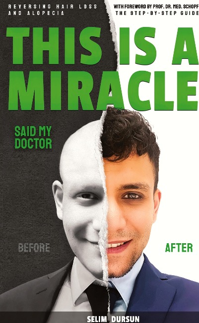 THIS IS A MIRACLE SAID MY DOCTOR: REVERSING HAIR LOSS AND ALOPECIA
