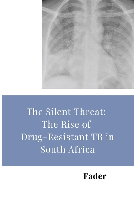The Silent Threat: The Rise of Drug-Resistant TB in South Africa