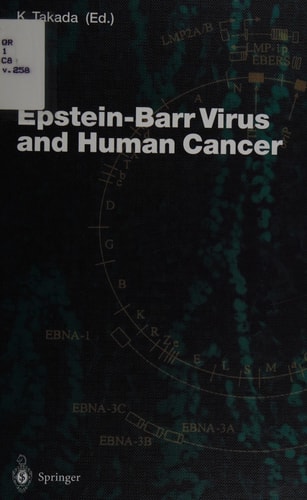 Epstein-Barr Virus and Human Cancer