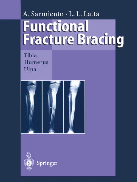 Functional Fracture Bracing: Tibia, Humerus, and Ulna