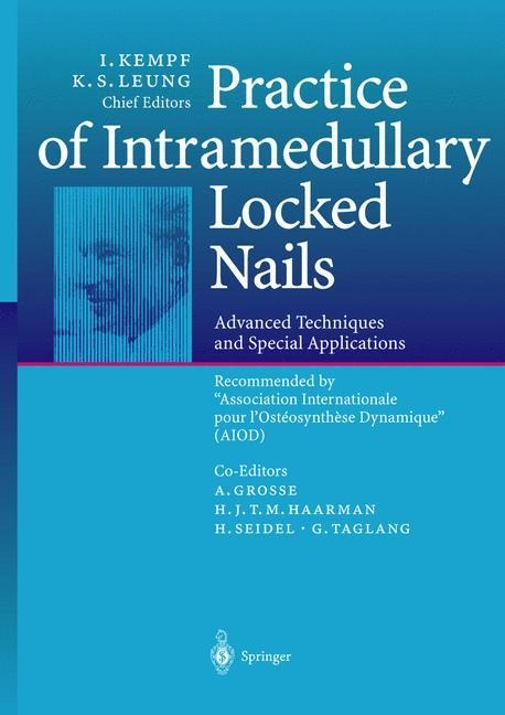 Practice of Intramedullary Locked Nails: Advanced Techniques and Special Applications Recommended by Association Internationale pour lOstéosynthèse Dynamique (AIOD)
