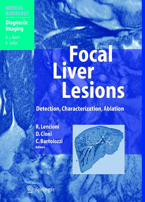 Focal Liver Lesions: Detection, Characterization, Ablation