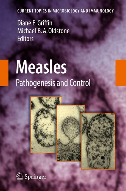 Measles: Pathogenesis and Control