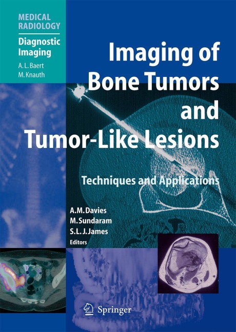 Imaging of Bone Tumors and Tumor-Like Lesions: Techniques and Applications