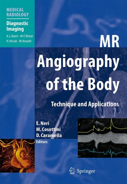 MR Angiography of the Body: Technique and Clinical Applications