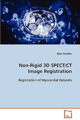 Non-Rigid 3D SPECT/CT Image Registration: Registration of Myocardial Datasets