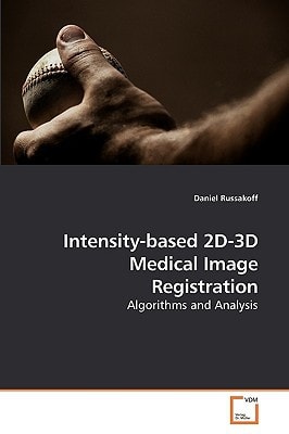Intensity-based 2D-3D Medical Image Registration: Algorithms and Analysis