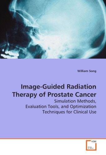 Image-Guided Radiation Therapy of Prostate Cancer: Simulation Methods, Evaluation Tools, and Optimization Techniques for Clinical Use