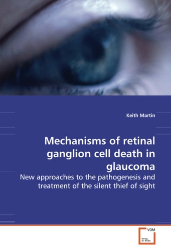 Mechanisms of retinal ganglion cell death in glaucoma: New approaches to the pathogenesis and treatment of the silent thief of sight