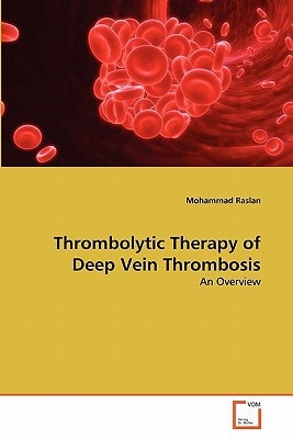 Thrombolytic Therapy of Deep Vein Thrombosis: An Overview