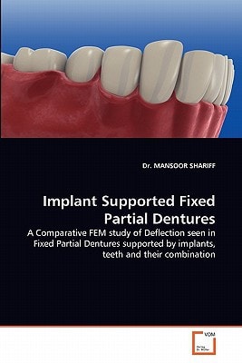 Implant Supported Fixed Partial Dentures: A Comparative FEM study of Deflection seen in Fixed Partial Dentures supported by implants, teeth and their combination