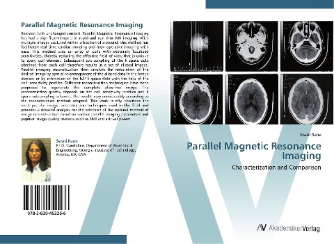 Parallel Magnetic Resonance Imaging: Characterization and Comparison