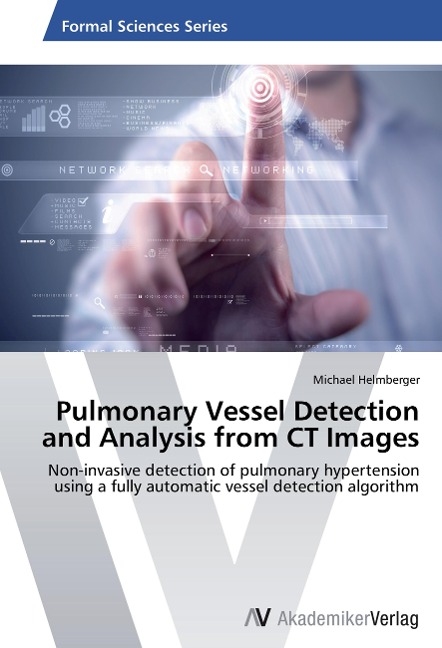 Pulmonary Vessel Detection and Analysis from CT Images: Non-invasive detection of pulmonary hypertension using a fully automatic vessel detection algorithm