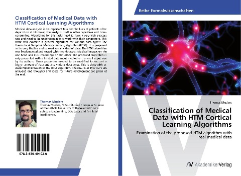Classification of Medical Data with HTM Cortical Learning Algorithms: Examination of the proposed HTM algorithm with real medical data