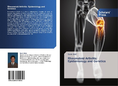 Rheumatoid Arthritis: Epidemiology and Genetics