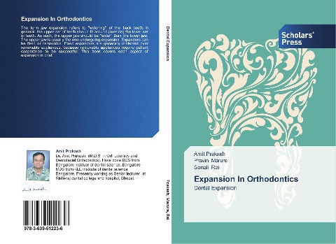 Expansion In Orthodontics: Dental Expansion