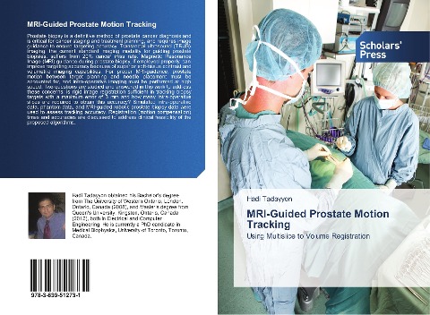 MRI-Guided Prostate Motion Tracking: Using Multislice to Volume Registration