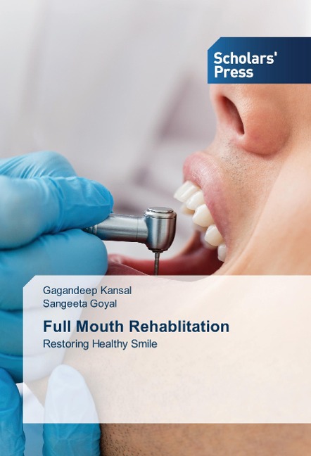 Full Mouth Rehablitation: Restoring Healthy Smile