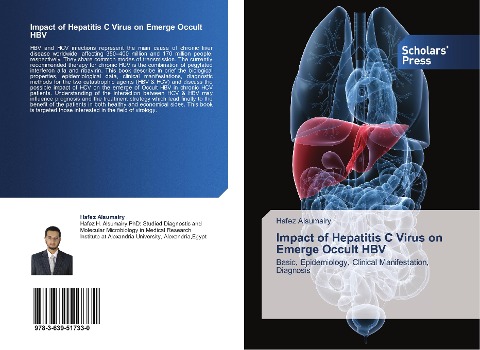 Impact of Hepatitis C Virus on Emerge Occult HBV: Basic, Epidemiology, Clinical Manifestation, Diagnosis