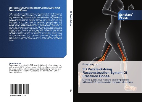 3D Puzzle-Solving Resconstruction System Of Fractured Bones: Making quantitative fracture severity possible with novel 3D puzzle-solving computer algorithms