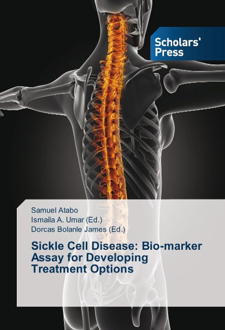 Sickle Cell Disease: Bio-marker Assay for Developing Treatment Options
