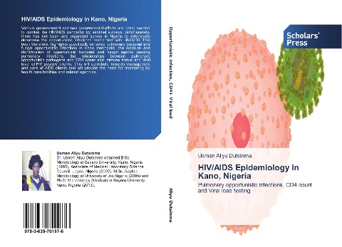 HIV/AIDS Epidemiology in Kano, Nigeria: Pulmonary opportunistic infections, CD4 count and Viral load testing