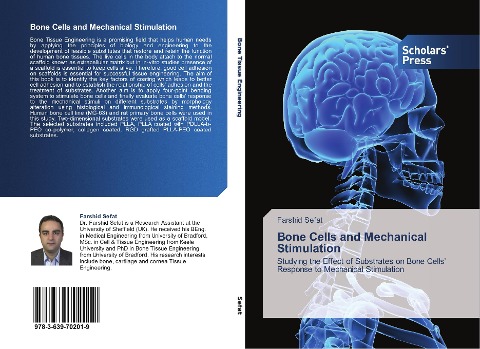 Bone Cells and Mechanical Stimulation: Studying the Effect of Substrates on Bone Cells Response to Mechanical Stimulation