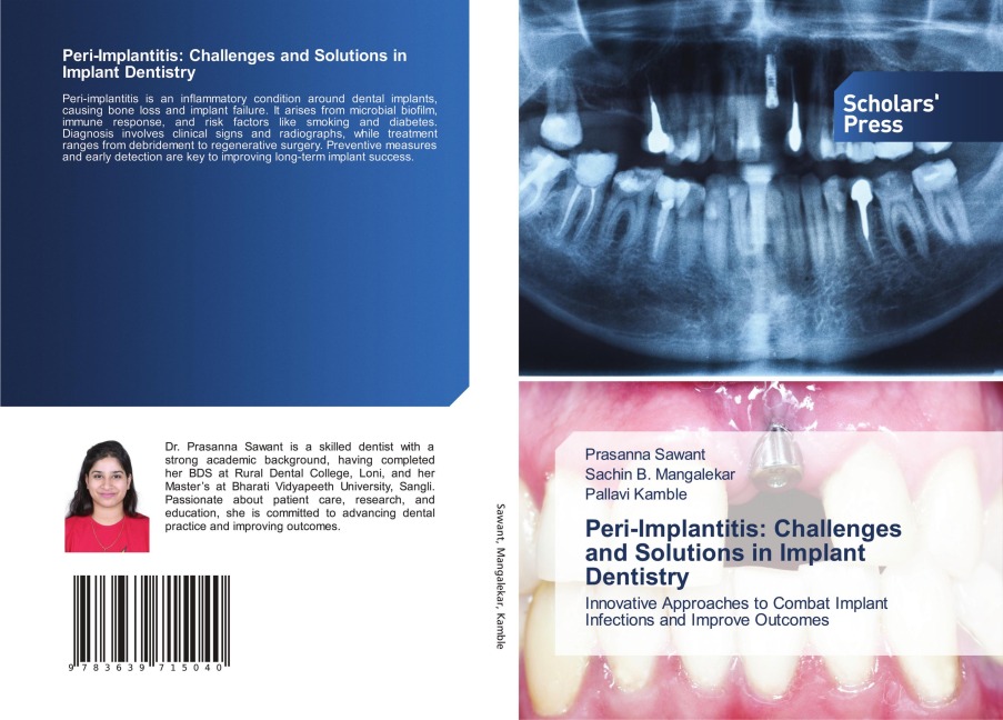 Peri-Implantitis: Challenges and Solutions in Implant Dentistry: Innovative Approaches to Combat Implant Infections and Improve Outcomes