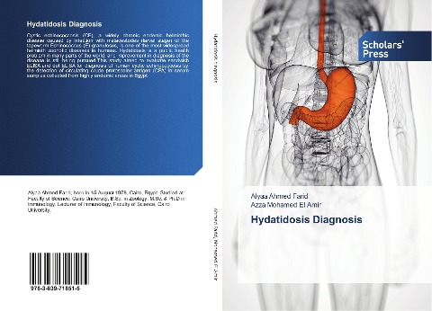 Hydatidosis Diagnosis