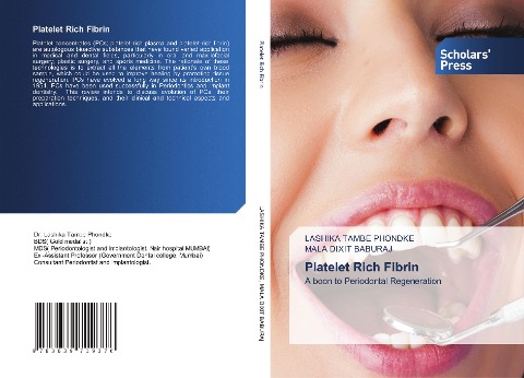 Platelet Rich Fibrin: A boon to Periodontal Regeneration
