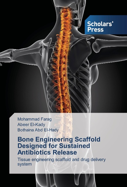 Bone Engineering Scaffold Designed for Sustained Antibiotics Release: Tissue engineering scaffold and drug delivery system