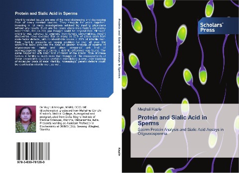 Protein and Sialic Acid in Sperms: Sperm Protein Analysis and Sialic Acid Assays in Oligozoospermia
