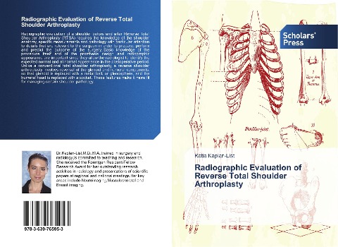 Radiographic Evaluation of Reverse Total Shoulder Arthroplasty