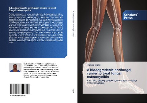 A biodegradable antifungal carrier to treat fungal osteomyelitis: An in-vitro biodegradable bone cement to deliver antifungal agents
